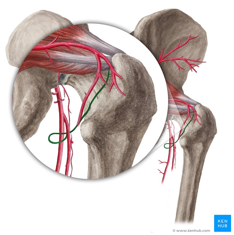 Anomalous Configuration Of Medial And Lateral Circumflex Femoral ...
