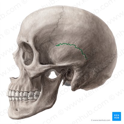 The back part of the reference skull is cut away.