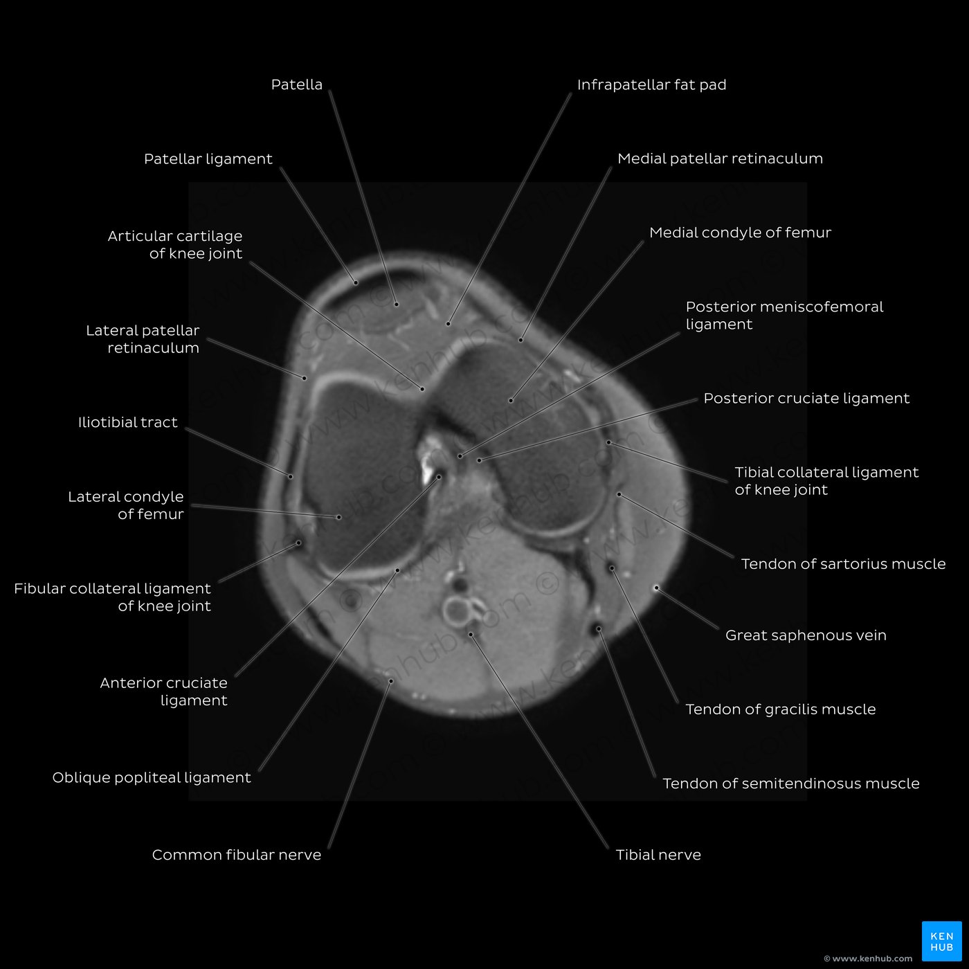Radiological anatomy: X-ray, CT, MRI | Kenhub